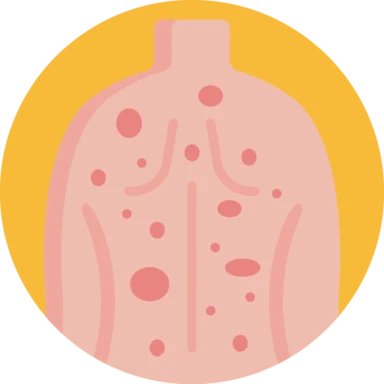 Allergies icon 1 of 10